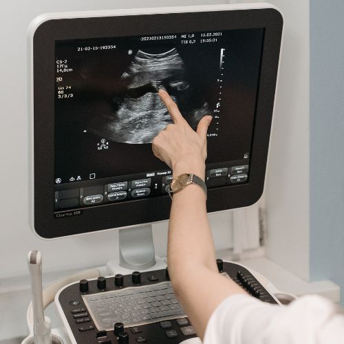 A woman pointing at an ultrasound screen.